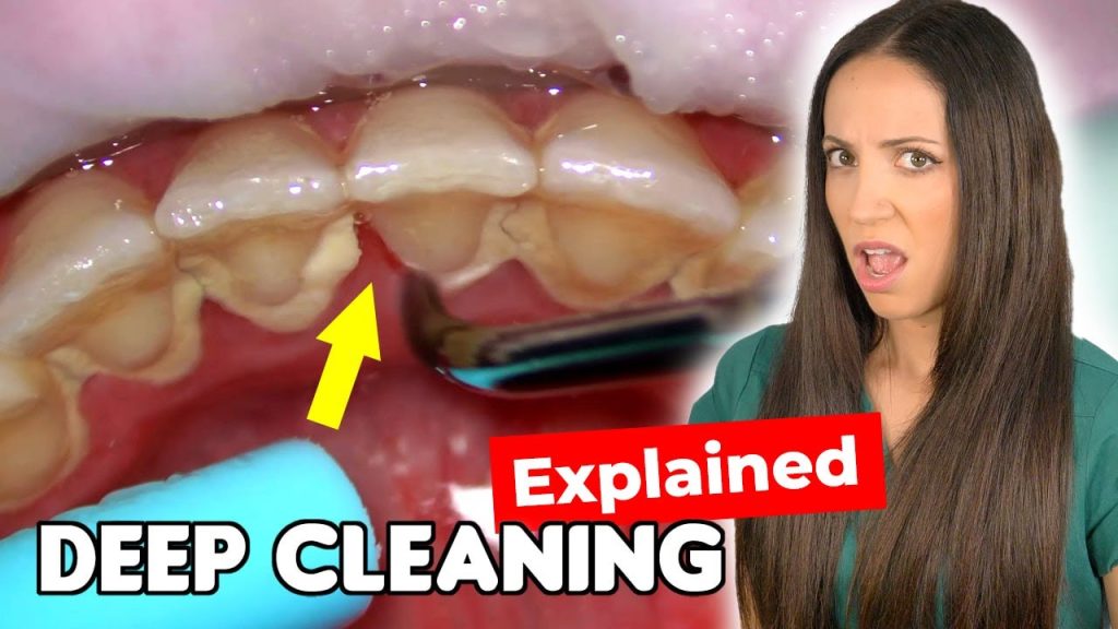 How Painful Is Deep Cleaning?